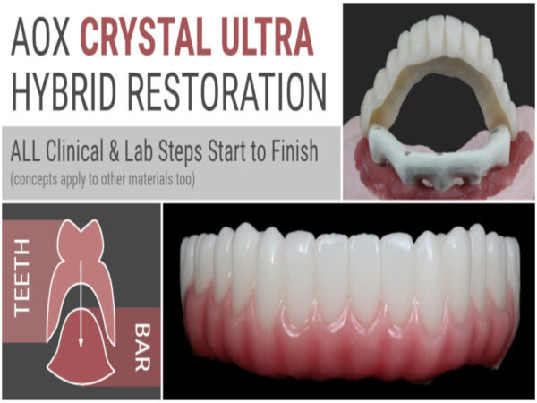 AOX Crystal Ultra Hybrid Restoration – ALL Clinical & Lab Steps Start to Finish